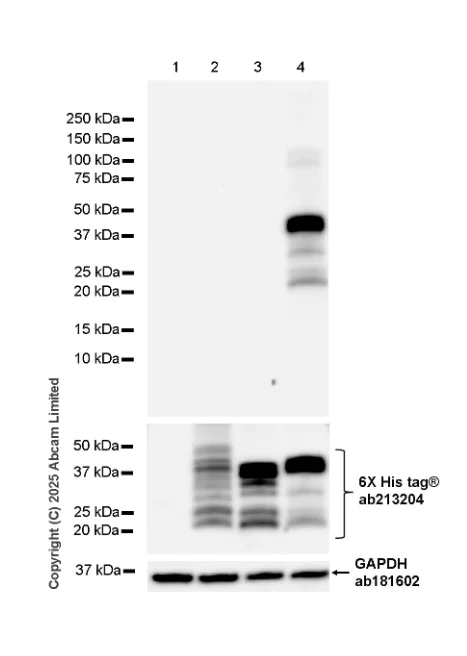 Western blot - Anti-HBV envelope L+M+S protein antibody [EPR29889-558] (AB324674)
