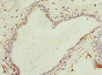 Immunohistochemistry (Formalin/PFA-fixed paraffin-embedded sections) - Anti-HBXIP antibody (AB223487)