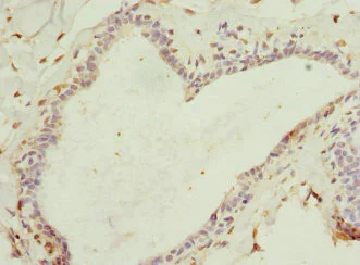 Immunohistochemistry (Formalin/PFA-fixed paraffin-embedded sections) - Anti-HBXIP antibody (AB223487)
