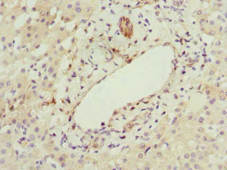Immunohistochemistry (Formalin/PFA-fixed paraffin-embedded sections) - Anti-HBXIP antibody (AB223487)