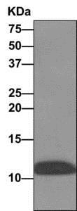 Western blot - Anti-HBXIP antibody [EPR11531(B)] - BSA and Azide free (AB249343), expandable thumbnail
