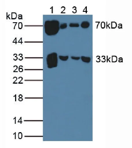 Western blot - Anti-HC-II antibody (AB232859)