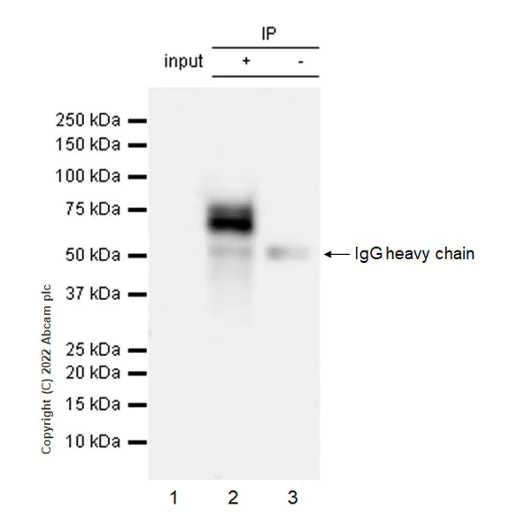 Immunoprecipitation - Anti-HC-II antibody [EPR25618-1] - BSA and Azide free (AB289996)