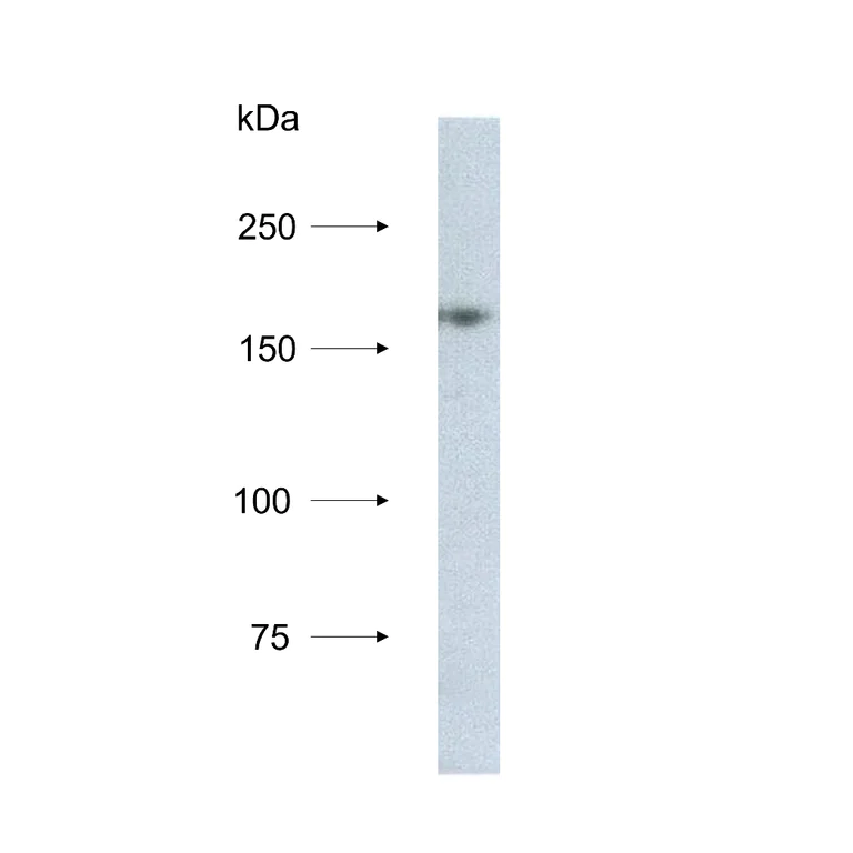 Western blot - Anti-hCAP-D3 Antibody [2B5] (AB316348)