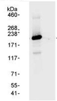 Immunoprecipitation - Anti-hCAP-D3 antibody (AB70349), expandable thumbnail