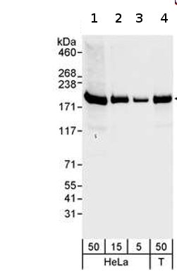 Western blot - Anti-hCAP-D3 antibody (AB70349), expandable thumbnail