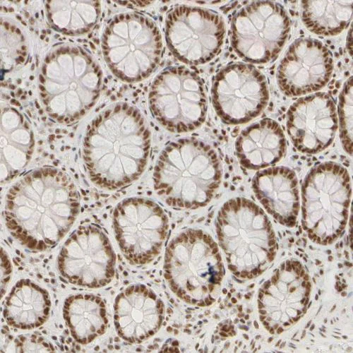 Immunohistochemistry (Formalin/PFA-fixed paraffin-embedded sections) - Anti-HCC1 antibody (AB244254)