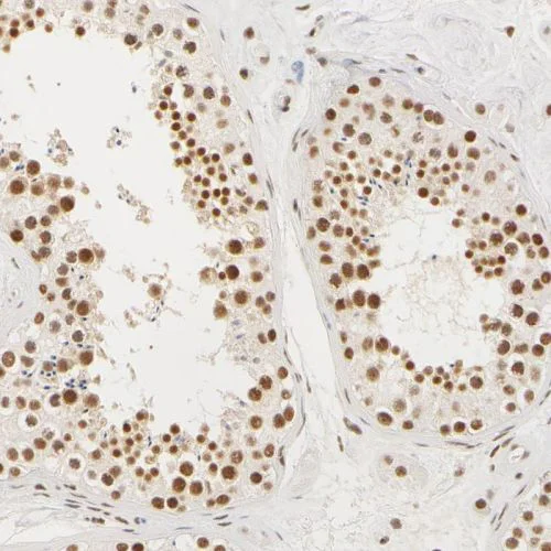 Immunohistochemistry (Formalin/PFA-fixed paraffin-embedded sections) - Anti-HCC1 antibody (AB244254)