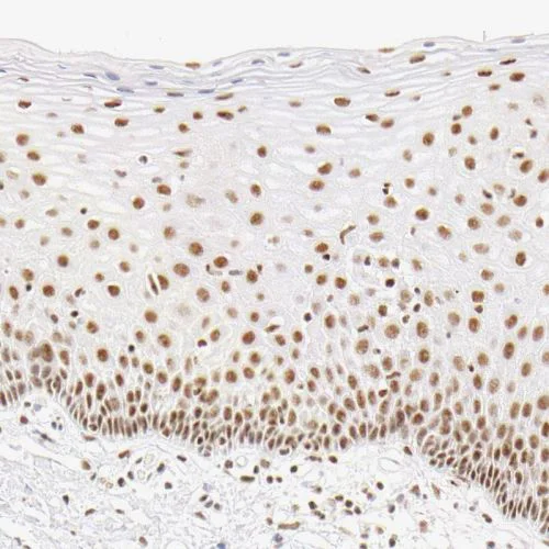 Immunohistochemistry (Formalin/PFA-fixed paraffin-embedded sections) - Anti-HCC1 antibody (AB244254)