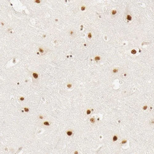 Immunohistochemistry (Formalin/PFA-fixed paraffin-embedded sections) - Anti-HCC1 antibody (AB244254)