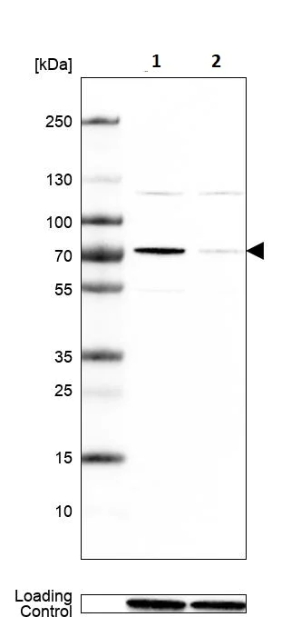 Western blot - Anti-HCC1 antibody (AB244254)