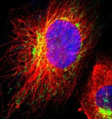 Immunocytochemistry/ Immunofluorescence - Anti-HCCS antibody (AB224321)