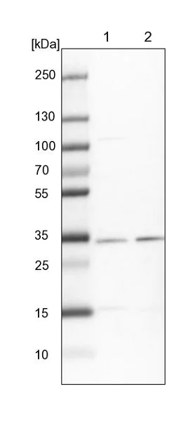 Western blot - Anti-HCCS antibody (AB224321)