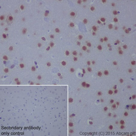 Anti-HCE antibody [EPR19384]