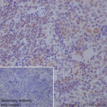 Immunohistochemistry (Formalin/PFA-fixed paraffin-embedded sections) - Anti-HCE antibody [EPR19384] - BSA and Azide free (AB251333)
