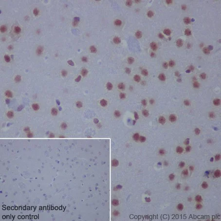 Immunohistochemistry (Formalin/PFA-fixed paraffin-embedded sections) - Anti-HCE antibody [EPR19384] - BSA and Azide free (AB251333)