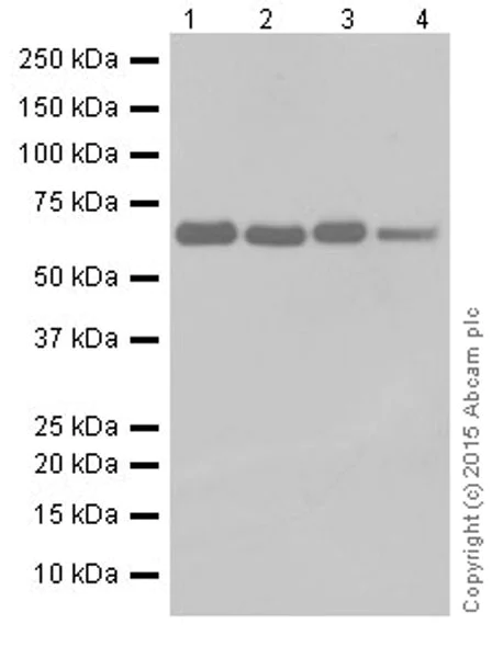 Western blot - Anti-HCE antibody [EPR19384] - BSA and Azide free (AB251333)