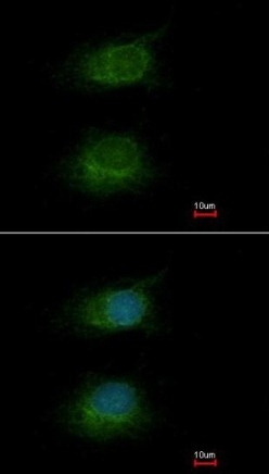 Immunocytochemistry/ Immunofluorescence - Anti-HCF-1 / Host Cell Factor C1 antibody - N-terminal (AB137618), expandable thumbnail
