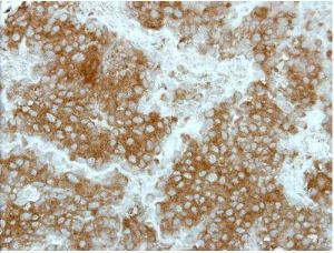 Immunohistochemistry (Formalin/PFA-fixed paraffin-embedded sections) - Anti-HCF-1 / Host Cell Factor C1 antibody - N-terminal (AB137618), expandable thumbnail