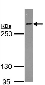 Western blot - Anti-HCF-1 / Host Cell Factor C1 antibody - N-terminal (AB137618), expandable thumbnail