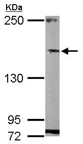 Western blot - Anti-HCF-1 / Host Cell Factor C1 antibody - N-terminal (AB137618), expandable thumbnail