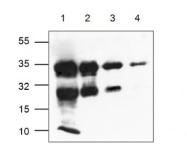Western blot - Anti-hCG antibody (AB54410), expandable thumbnail