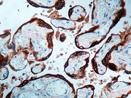 Immunohistochemistry (Formalin/PFA-fixed paraffin-embedded sections) - Anti-hCG antibody (AB9376)