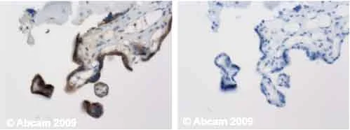Immunohistochemistry (Formalin/PFA-fixed paraffin-embedded sections) - Anti-hCG antibody (AB9376)