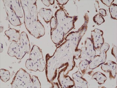 Immunohistochemistry (Formalin/PFA-fixed paraffin-embedded sections) - Anti-hCG antibody [RM330] (AB238319)