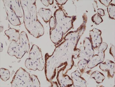 Immunohistochemistry (Formalin/PFA-fixed paraffin-embedded sections) - Anti-hCG antibody [RM330] (AB238319)