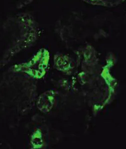 Immunohistochemistry (Formalin/PFA-fixed paraffin-embedded sections) - Anti-hCG beta antibody [5H4-E2] (AB9582)