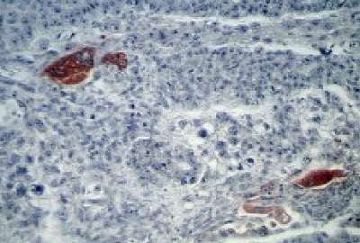 Immunohistochemistry (Formalin/PFA-fixed paraffin-embedded sections) - Anti-hCG beta antibody [5H4-E2] (AB9582)