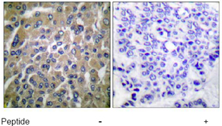 Immunohistochemistry (Formalin/PFA-fixed paraffin-embedded sections) - Anti-hCG beta antibody (AB53087)
