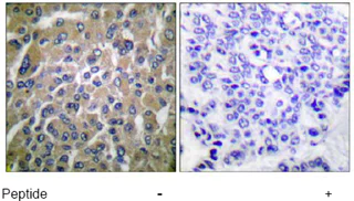 Immunohistochemistry (Formalin/PFA-fixed paraffin-embedded sections) - Anti-hCG beta antibody (AB53087)