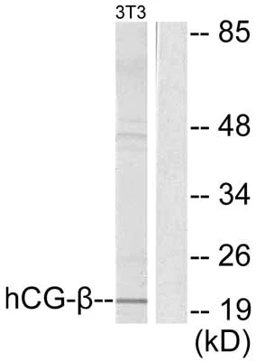 Western blot - Anti-hCG beta antibody (AB53087)