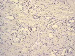 Immunohistochemistry (Formalin/PFA-fixed paraffin-embedded sections) - Anti-hCG beta antibody [EPHCGR2] (AB131170)