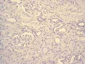 Immunohistochemistry (Formalin/PFA-fixed paraffin-embedded sections) - Anti-hCG beta antibody [EPHCGR2] (AB131170)