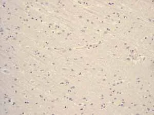Immunohistochemistry (Formalin/PFA-fixed paraffin-embedded sections) - Anti-hCG beta antibody [EPHCGR2] (AB131170)