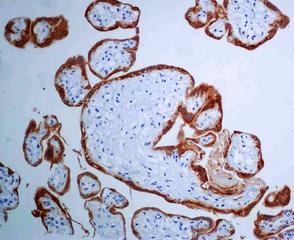 Immunohistochemistry (Formalin/PFA-fixed paraffin-embedded sections) - Anti-hCG beta antibody [EPHCGR2] (AB131170)