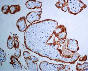 Immunohistochemistry (Formalin/PFA-fixed paraffin-embedded sections) - Anti-hCG beta antibody [EPHCGR2] (AB131170)