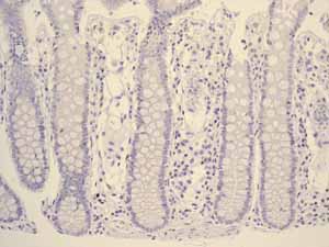 Immunohistochemistry (Formalin/PFA-fixed paraffin-embedded sections) - Anti-hCG beta antibody [EPHCGR2] - BSA and Azide free (ab248368), expandable thumbnail