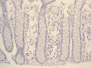 Immunohistochemistry (Formalin/PFA-fixed paraffin-embedded sections) - Anti-hCG beta antibody [EPHCGR2] - BSA and Azide free (AB248368)