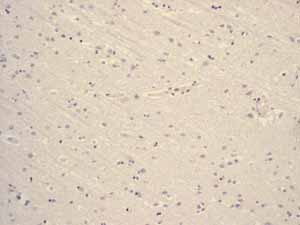 Immunohistochemistry (Formalin/PFA-fixed paraffin-embedded sections) - Anti-hCG beta antibody [EPHCGR2] - BSA and Azide free (AB248368), expandable thumbnail