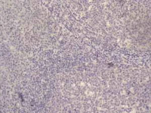 Immunohistochemistry (Formalin/PFA-fixed paraffin-embedded sections) - Anti-hCG beta antibody [EPHCGR2] - BSA and Azide free (AB248368)