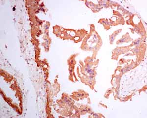 Immunohistochemistry (Formalin/PFA-fixed paraffin-embedded sections) - Anti-hCG beta antibody [EPHCGR2] - BSA and Azide free (AB248368), expandable thumbnail