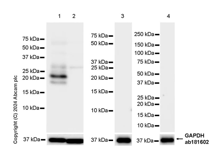 Western blot - Anti-hCG beta antibody [EPR28726-38] (AB317567)