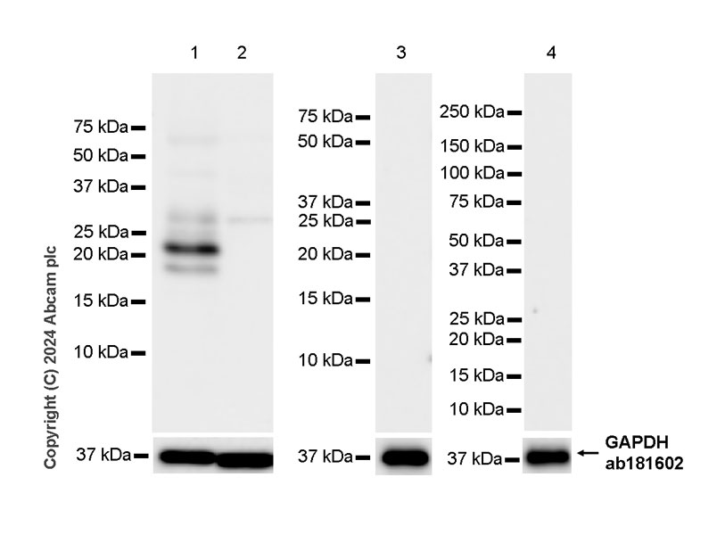 Western blot - Anti-hCG beta antibody [EPR28726-38] - BSA and Azide free (AB317568)