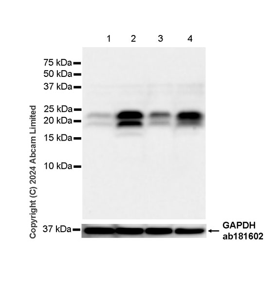 Western blot - Anti-hCG beta antibody [EPR28726-38] - BSA and Azide free (AB317568)