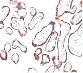Immunohistochemistry (Formalin/PFA-fixed paraffin-embedded sections) - Anti-hCG beta antibody [HCGb/54] (AB187285)
