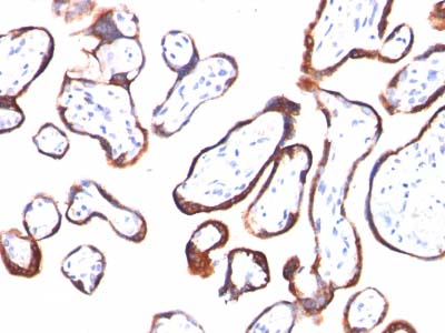 Immunohistochemistry (Formalin/PFA-fixed paraffin-embedded sections) - Anti-hCG beta antibody [HCGb/54] - BSA and Azide free (AB212279)